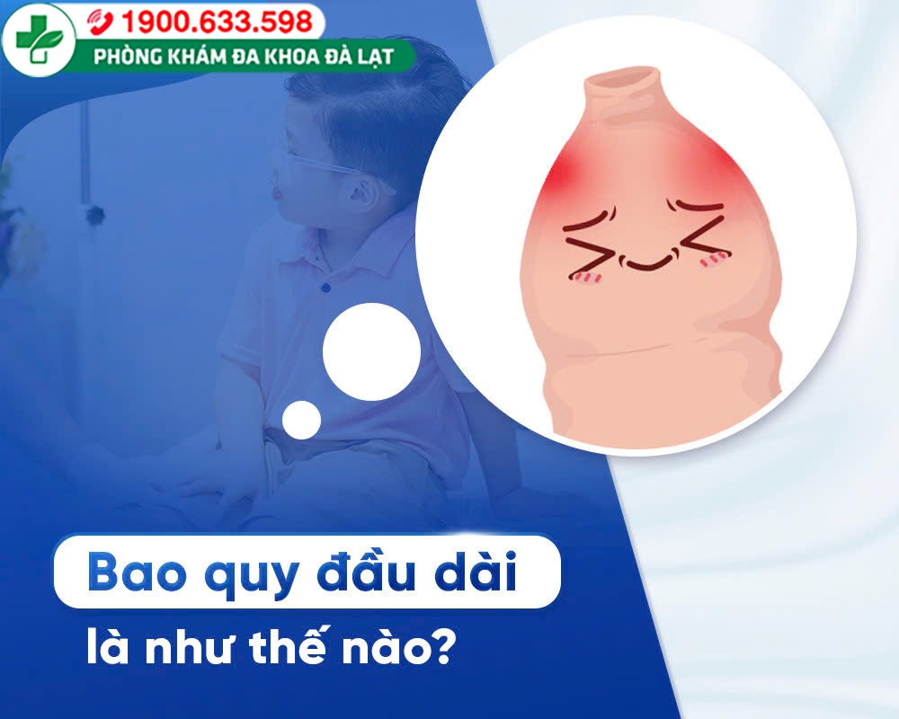 Hình ảnh minh họa